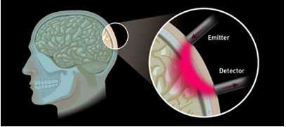 Near-Infrared Fiber Optic Cable